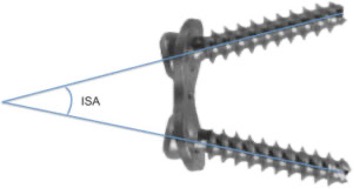 الصياد لجراحة العظام